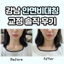 강남약손한의원 | 강남 안면비대칭 한의원 교정 후기 가격 추나요법 실비