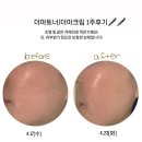 바이멜 이미지