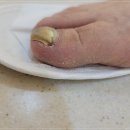 페디네일 이미지