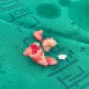 씨유원광대병원신관점 | 매복사랑니 발치수술 후기 (원광대산본치과, 통증, 회복기간, 식사, 실밥제거, 관리)