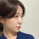 라시옹 이미지