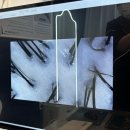 에이치토탈헤어라인 네이버블로그
