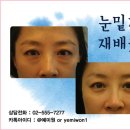 예미원피부과