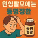 동명의원 | “원형탈모도 회복됐다!” 50대 남성, 동명정환으로 31주 만에 탈모 극복한 리얼 후기