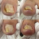 굴화2길 | 울산 굴화 내성발톱 전문케어 잘하는 곳 네일이룸 페디크루 울산점