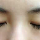 고운피부나라