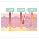 메드케이 이미지