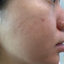 유명약품 | 약국템 일양약품 닥터프리메틱 기미미백크림 솔직사용후기(기미미백추천)