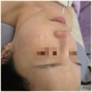 아이스킨 이미지