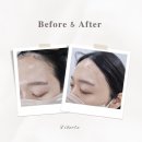 아이비메디칼 | 송도미용학원 피부미용 진로준비 후기