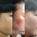 함께 인셀덤