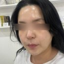 뮤즈뷰티(MUSE BEAUTY) | 서대문피부관리 찾다가 발견한 뮤즈뷰티 — 코·나비존 모공관리 받고 인생 관리 찾음!