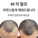 오직 스칼프 | 노원두피문신 잘하는곳, 마이스칼프 원장님이 알려주는 체크리스트