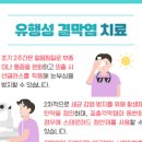 유행성 결막염 여름철 유행성결막염 원인 여름철 눈병 주의 유행성결막염 이미지