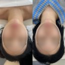 스튜디오 사유: 스킨앤두피케어 | 전포동 피부관리 <플로우스튜디오> 내돈내산 윤곽리프팅 찐만족 후기