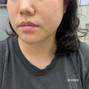 쿨패스 | 더나의원 강남 쿨소닉 리프팅 효과 후기 웰니스하우스 서울 쇼핑[30대의 자기관리편]