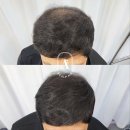 일산두피&눈썹단미토탈뷰티