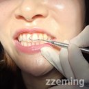 뉴욕이치과의원 | 서현역치과 와타나배 구강관리 솔직 후기 뉴욕치과