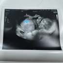 마포구보건소 | 마포구 보건소 임산부등록 후기 준비물, 초기검사, 임산부뱃지, 축하선물