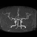 CT 와 MRI 그리고 MRA 의 차이점 이미지