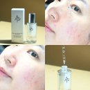 피부과 관리* 대체템 에이피 뷰티 트리플 샷 세럼 사용후기!