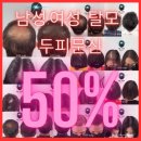 장안7 | 장안구두피문신 직접 보고 결정한 후기 – 정수리탈모 고민 해결! 7년 경력 대표원장 시술