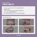 명성치과의원 | 범계치과? 임플란트 성공은 &#39;이것&#39;으로 갈립니다 &lt;필독&gt;