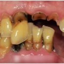 서울민플란트치과의원 이미지