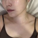 채움피부관리실 | [화성] 동탄 피부관리 맛집, '채움피부연구소'에서 빛날톡테라피 받고 온 후기