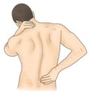 요통(Low back pain) 이미지