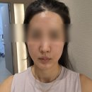 하남북위례 품태권도장 | 위례 피부과 추천 5월 이벤트 얼른 다녀오세요! [내돈내산]