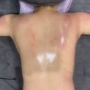7302 | 대구동구마사지 수연테라피 대구체형교정