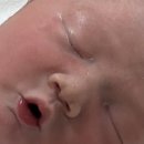 봄빛병원 | [봄빛병원]제왕절개 및 입원후기(고통을 곁들인..)