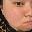 지엠메디칼 | [리뷰] 촉촉하고 붉은기 잡아주는 마스크팩 추천! '퓨라지엠 위치하젤 시트팩'