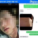 [단독] "폭행 증거 사진은, 가짜"…김하성, 협박 사건의 진실 이미지