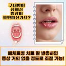 서울류마내과의원 | 서울 동대문구 류마내과 의원 전국 14개 지점이 전하는 류마티스 질환 정보