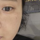 토탈기업 | #원주 기업도시 피부관리 플라즈마_뷰티온