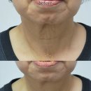 봉곡동015 이미지