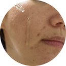 [사용후기] 홍조개선 업타운리즈 리바이탈 3종 set 사용후기