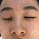 뷰티인시아 에스테틱 | [강남피부관리] 뷰티인시아 에스테틱 수분관리 후기