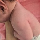 다나수의원 | 다나소아과 영유아1차검진 bcg피내용 후기