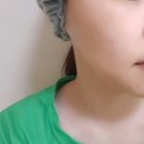 숲안에 스킨