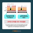 진성레이져 이미지