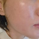 40대 주부 집에서 하는 피부관리 | 니딥 스타샷 500 후기 (미백, 잔주름 잡기)