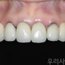 수정기공사 이미지