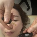 바른얼굴덕치과의원 | 인천 연수구 에스테틱 가인미가 송도 경락 얼굴축소관리 추천 후기