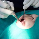 양재영치과의원 이미지