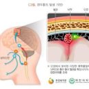 오른쪽 왼쪽 관자놀이 통증 원인 10가지와 두통 없애는 법 이미지