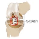 필라테스리버