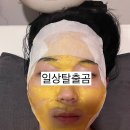 미스터피자(Mr.Pizza)창원점 | 창원 에스테틱 끌리메 내돈내산 창원점 끌링작은얼굴 관리 찐후기 창원웨딩관리 추천 얼굴비대칭 광대...